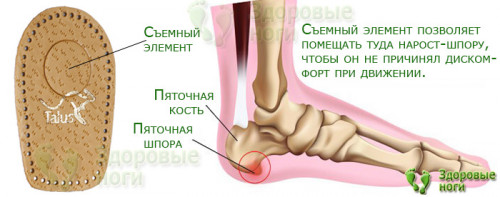 ortopedicheskie_podpjatochniki_pri_pjatochnoj_shpore_kue4caf83b991da356.jpg